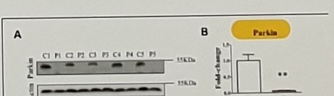 Zilocchi Parkin levels western blot and bar plot